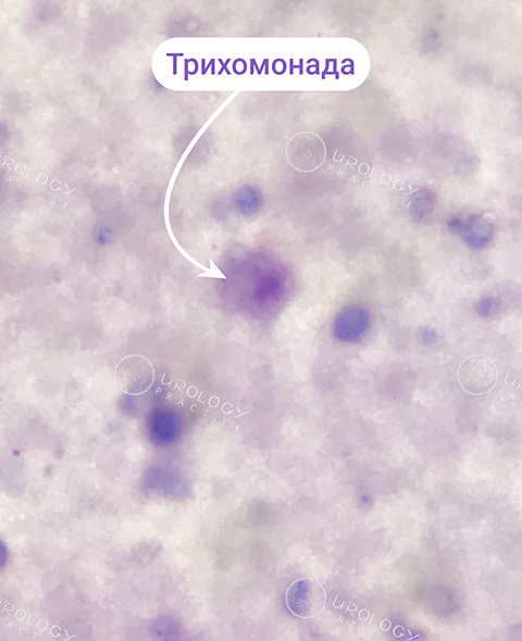 здати бак посів ціна
